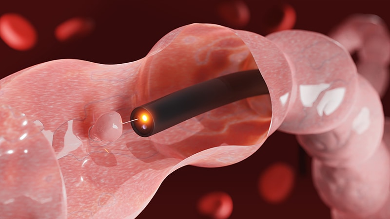Bowel Prep for Colonoscopy: Quality Matters