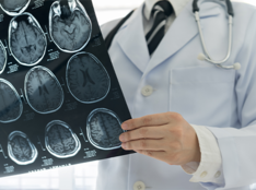 Improving the Timely and Equitable Diagnosis of Multiple Sclerosis